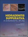 ＜p＞＜em＞Hidradenitis Suppurativa: A Diagnostic Atlas＜/em＞ provides a unique visual aid to the diagnosis of Hidradenitis Suppurativa (HS), also known as "acne inversa." The book covers the epidemiology and pathogenesis of the disease, its typical presentation, differences in manifestations of cutaneous versus systemic instances, and considerations for clinical and histopathological differential diagnosis. Guidance is also provided for the classification of disease severity and for managing the impact of HS on the patient's quality of life.＜/p＞ ＜p＞The book is packed with high-quality, full-color clinical images for each of the most common HS diagnostic imaging techniques, such as videodermatoscopy, ultrasound, computed tomography, and magnetic resonance imaging. As a clinical atlas, it helps dermatologists with differential diagnoses and correct assessments of disease severity, as well as possible complications of the condition. The book:＜/p＞ ＜ul＞ ＜li＞Is highly focused on acne inversa, which can have a debilitating impact on quality of life＜/li＞ ＜li＞Includes over 200 outstanding diagnostic clinical images＜/li＞ ＜li＞Covers all imaging modalities used in the diagnosis and management of Hidradenitis Suppurativa＜/li＞ ＜/ul＞ ＜p＞This book is a key resource for dermatologists, dermatopathologists, and dermatology nurses working with patients with HS.＜/p＞画面が切り替わりますので、しばらくお待ち下さい。 ※ご購入は、楽天kobo商品ページからお願いします。※切り替わらない場合は、こちら をクリックして下さい。 ※このページからは注文できません。