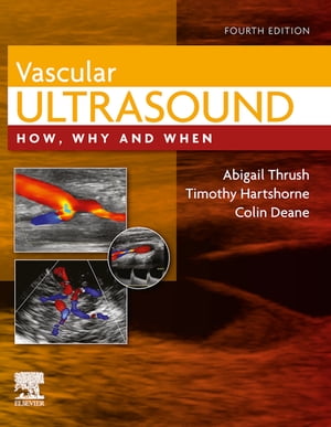 Vascular Ultrasound E-Book