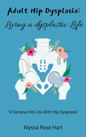 Adult hip Dysplasia: Living a Dysplasic Life【