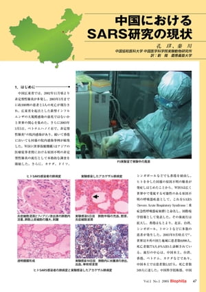 中国における SARS研究の現状【電子書籍】[ 孔 キ　、秦　川 ]