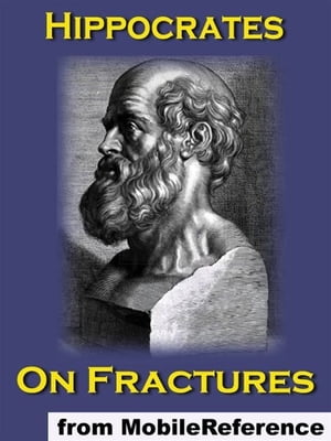 On Fractures (Mobi Classics)
