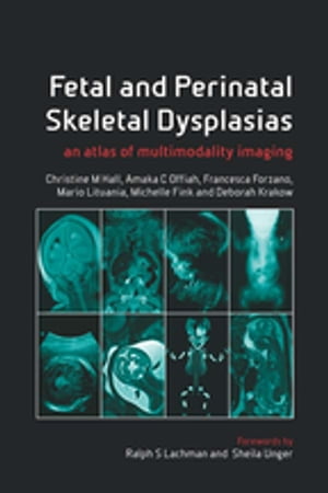 Fetal and Perinatal Skeletal Dysplasias