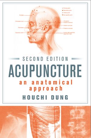 Acupuncture