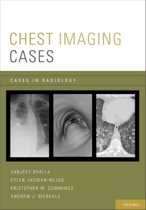 Chest Imaging CasesŻҽҡ[ Sanjeev Bhalla ]