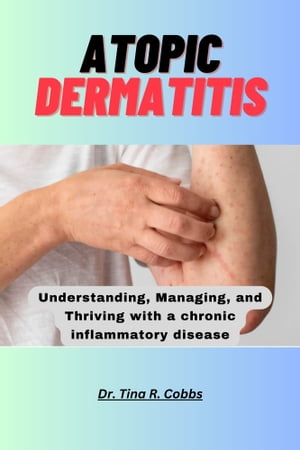 ATOPIC DERMATITIS