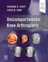 Unicompartmental Knee Arthroplasty, E-Book【電子書籍】 Richard D. Scott