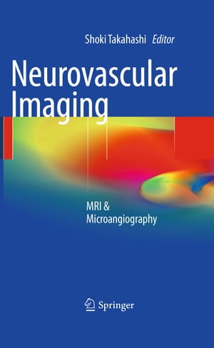 Neurovascular Imaging