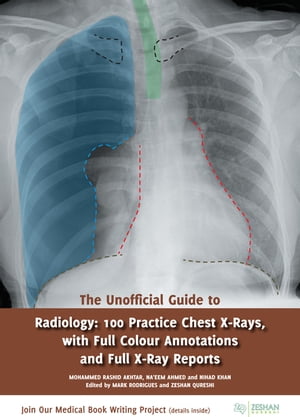 The Unofficial Guide to Radiology 100 Practice Chest X-Rays, with Full Colour Annotations and Full X-Ray Reports