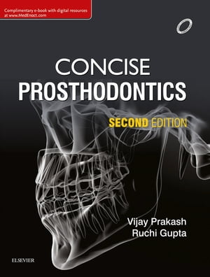 Concise Prosthodontics- E Book Prep Manual for Undergraduates