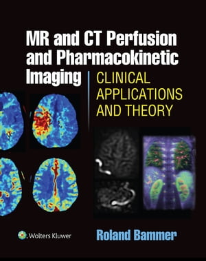 MR and CT Perfusion and Pharmacokinetic Imaging: Clinical Applications and Theoretical Principles