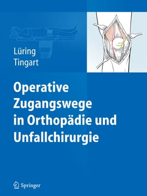 Operative Zugangswege in Orthop?die und Unfallchirurgie【電子書籍】