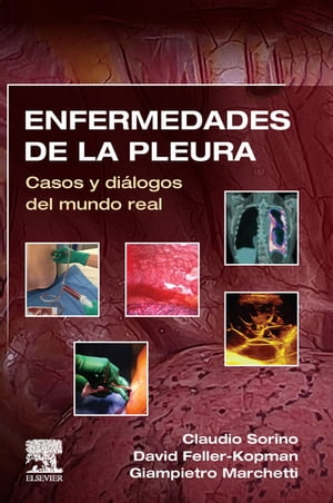 Enfermedades de la pleura