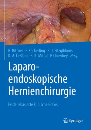 Laparo-endoskopische Hernienchirurgie Evidenzbasierte klinische Praxis