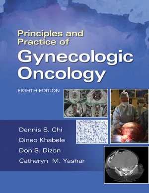 Principles and Practice of Gynecologic OncologyŻҽҡ[ Dennis Chi ]