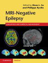 ŷKoboŻҽҥȥ㤨MRI-Negative Epilepsy Evaluation and Surgical ManagementŻҽҡۡפβǤʤ20,617ߤˤʤޤ