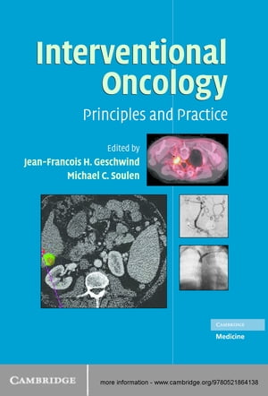 Interventional Oncology Principles and PracticeŻҽҡ