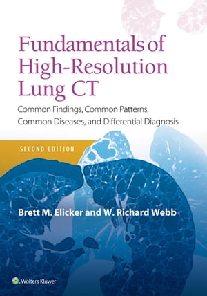 Fundamentals of High-Resolution Lung CT Common Findings, Common Patterns, Common Diseases and Differential Diagnosis