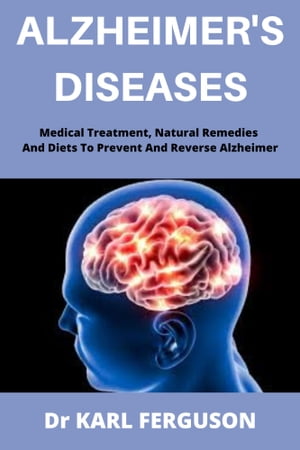 ALZHEIMER'S DISEASES