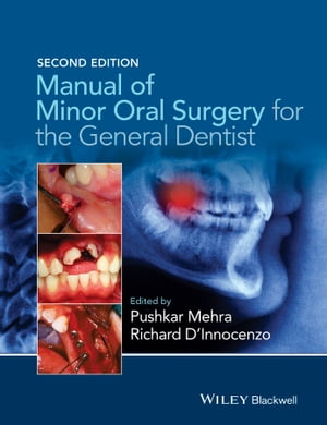 Manual of Minor Oral Surgery for the General Dentist【電子書籍】[ Pushkar Mehra ]