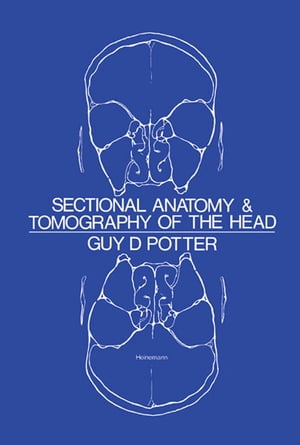 Sectional Anatomy and Tomography of the Head