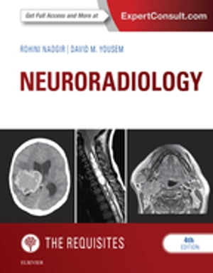 Neuroradiology: The Requisites E-Book