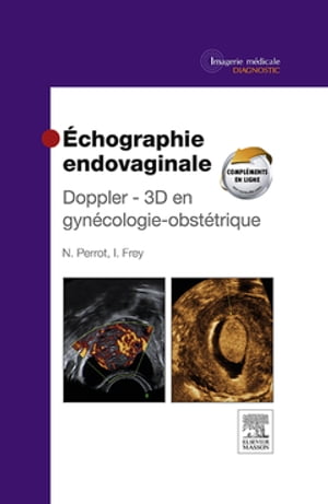 Échographie endovaginale Doppler - 3D