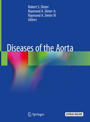 Diseases of the Aorta【電子書籍】