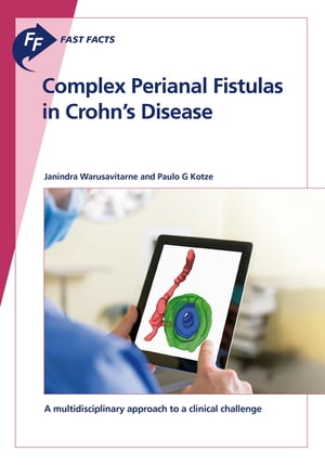 Fast Facts: Complex Perianal Fistulas in Crohn's Disease