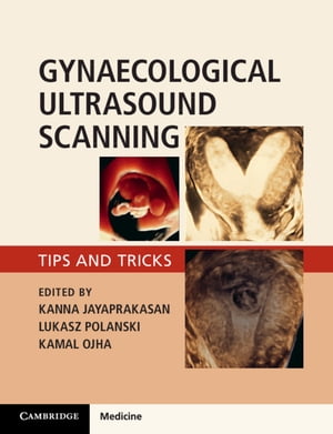 Gynaecological Ultrasound Scanning Tips and Tricks【電子書籍】[ Kanna Jayaprakasan ]