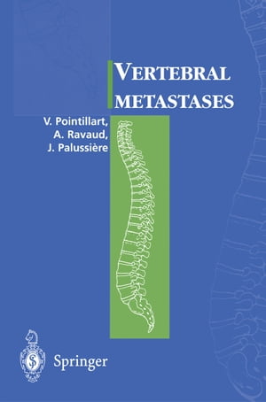 Vertebral metastases