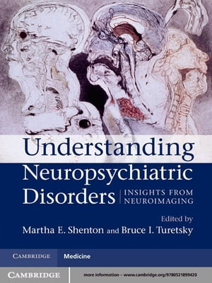 Understanding Neuropsychiatric Disorders Insights from NeuroimagingŻҽҡ