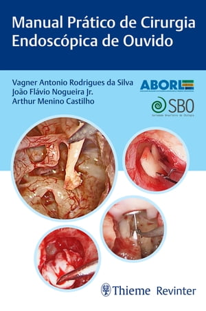 Manual Pr tico de Cirurgia Endosc pica de Ouvido【電子書籍】 Vagner Antonio Rodrigues da Silva