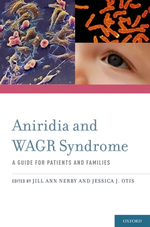 Aniridia and WAGR Syndrome A Guide for Patients and Their FamiliesŻҽҡ