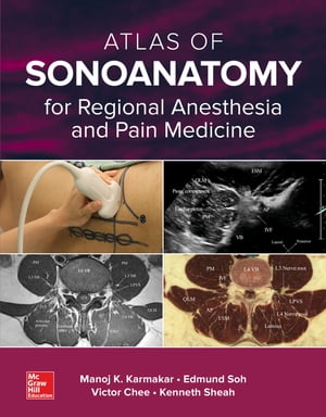 Atlas of Sonoanatomy for Regional Anesthesia and Pain Medicine【電子書籍】 Manoj Karmakar