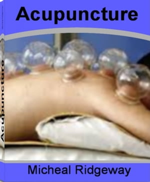 Acupuncture