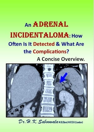 An Adrenal Incidentaloma: How Often Is It Detected & What Are the Complications? A Concise Overview.