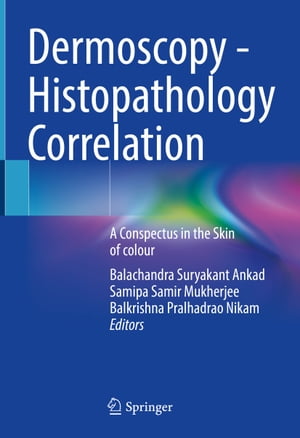 Dermoscopy - Histopathology Correlation A Conspectus in the Skin of colour【電子書籍】
