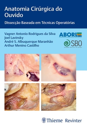 Anatomia Cir rgica do Ouvido Dissec o Baseada em T cnicas Operat rias【電子書籍】 Vagner Antonio Rodrigues da Silva