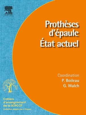 Prothèses d'épaule. État actuel