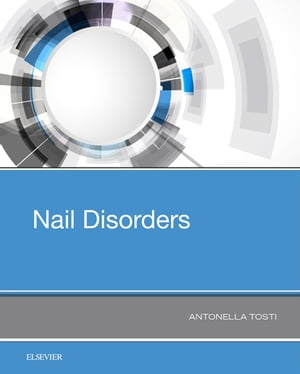 Nail Disorders【電子書籍】[ Antonella Tosti ]
