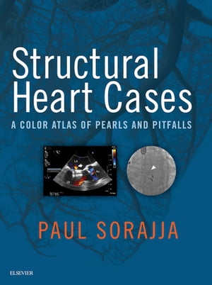 Structural Heart Cases E-Book