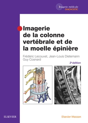 Imagerie de la colonne vertébrale et de la moelle épinière