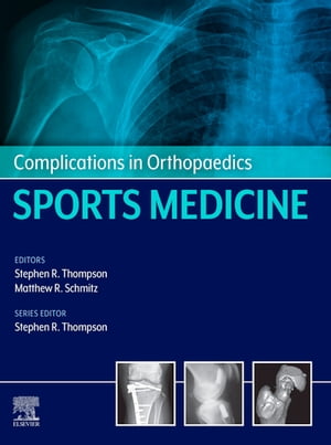 Complications in Orthopaedics: Sports Medicine E-BookŻҽҡ