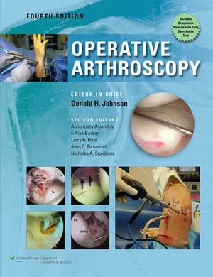 Operative Arthroscopy