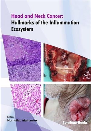 Head and Neck Cancer: Hallmarks of the Inflammation Ecosystem【電子書籍】 Norhafiza Mat Lazim
