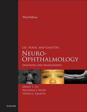 Liu, Volpe, and Galetta's Neuro-Ophthalmology E-Book Diagnosis and Management【電子書籍】[ Grant T. Liu ]