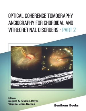 Optical Coherence Tomography Angiography for Choroidal and Vitreoretinal Disorders   Part 2