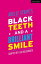 Black Teeth and a Brilliant Smile