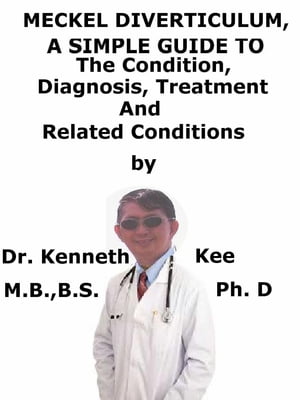 Meckel Diverticulum, A Simple Guide To The Condition, Diagnosis, Treatment And Related Conditions