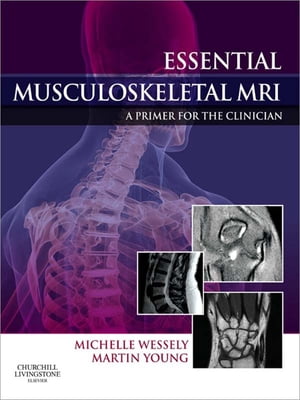 Essential Musculoskeletal MRI